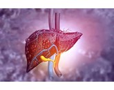 Nguy cơ mắc bệnh gan nhiễm mỡ không do rượu do bệnh tim mạch và đều gây tử vong ở bệnh nhân đái tháo đường týp 2