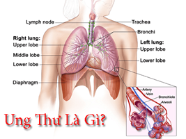 Nguyên nhân ung thư bắt nguồn từ đâu?