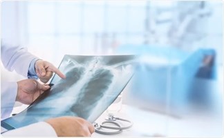 Quy trình chụp thể tích phổi