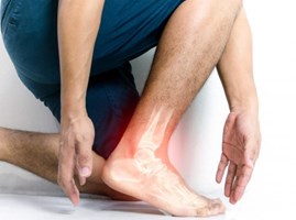 Tiền sử viêm khớp