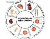 Triệu chứng bệnh tiểu đường loại 2