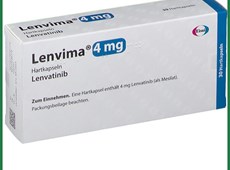 ung thư não: dấu hiệu, nguyên nhân và cách chẩn đoán bệnh