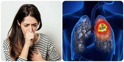 Ung thư phổi và mất cân bằng điện giải