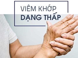 Viêm khớp là gì?